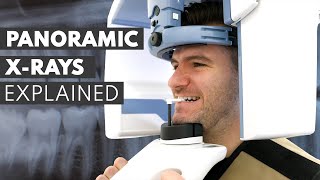 Panoramic Dental XRay Procedure EXPLAINED [upl. by Bobbie536]