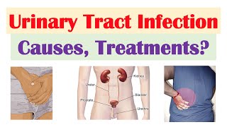 Urinary Tract Infections UTI Overview  Causes Risk Factors Symptoms Diagnosis Treatment [upl. by Gnahk]