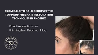 From Bald to Bold Discover the Top PainFree Hair Restoration Techniques in Phoenix [upl. by Eneliak]