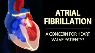 Atrial Fibrillation amp Heart Valve Disease Surgeon Insights with Dr Marc Gerdisch [upl. by Ball884]