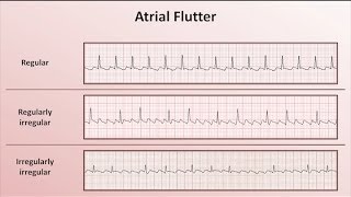 Intro to EKG Interpretation  Overview of Tachyarrhythmias [upl. by Langer981]