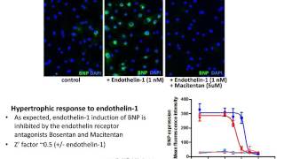 Using Human Cardiomyocytes in Phenotypic Screens and Target Verification [upl. by Ronn701]