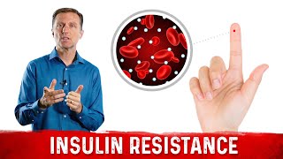 Understanding Insulin Resistance amp What You Can Do About It – DrBerg [upl. by Ocirnor19]