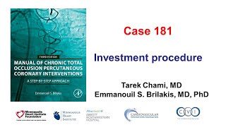 Case 181 Manual of CTO PCI  Investment procedure [upl. by Melitta]