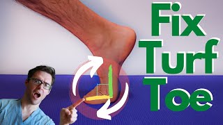 Turf Toe Injury BEST Treatment Causes Symptoms amp 3 Grades [upl. by Eussoj]