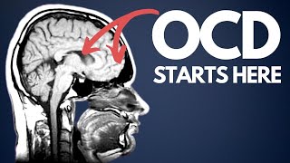 OCD explained for beginners  how I wish I was taught [upl. by Inalaehon116]