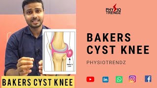 Bakers cyst and Physiotherapy shorts knee pain [upl. by Ahsinaj787]