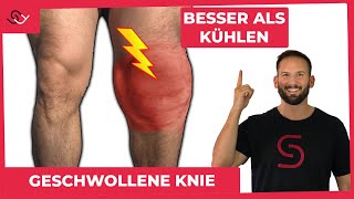 Geschwollene Knie  DAS musst du wissen  hilfreicher Trick [upl. by Brand]