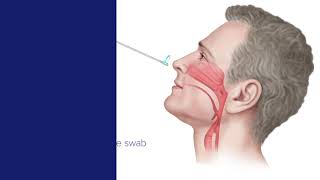 SARSCoV2 Clinician Collected Nasopharyngeal Specimen Collection Guide [upl. by Glanville644]