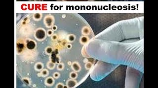 Cure for Mononucleosis [upl. by Ellesig678]