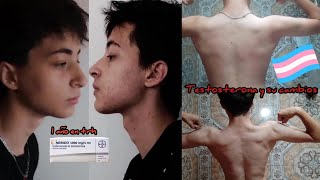 🏳️‍⚧️ Tratamiento hormonal en chicos trans  1 año en testosterona mi experiencia [upl. by Nnaylloh468]