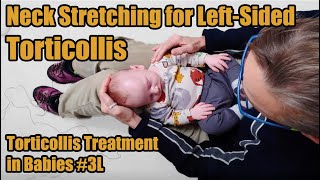 3L Neck Stretches for Leftsided Torticollis Torticollis Treatment in Babies [upl. by Chiquita]