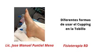 Diferentes formas de utilizar el Cupping en el Tobillo  FisioterapiaRD  Cupping 11 [upl. by Elsilrac]