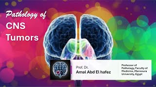 CNS Brain TumorsNeoplasms شرح محاضرة [upl. by Cyrill]