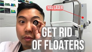 How to get rid of floaters in 2 MINUTES BUT IS IT SAFE  Ophthalmologist MichaelRChuaMD [upl. by Cristie]