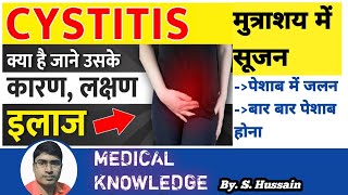 Cystitis symptoms causes treatment मुत्राशय में सुजन संक्रमण [upl. by Atinet]