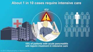 Management and Treatment of Acute Pancreatitis [upl. by Charin742]