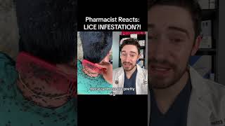 LICE INFESTATION 😳 pharmacist doctorreacts licecomb pharmacy bugs shorts [upl. by Henrietta]