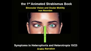 Symptoms in Heterophoria and Heterotropia and the Psychological Effects of Strabismus [upl. by Amak]