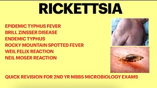 Rickettsia  Microbiology  Typhus fever  Weil felix test Rickettsial infection [upl. by Loggia]