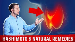 Best Nutrients For Hashimotos Thyroiditis – Dr Berg [upl. by Patterman447]