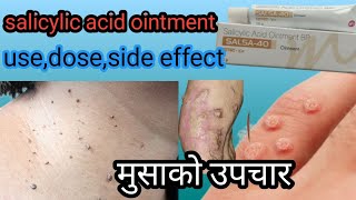 salicylic acid ointment use in nepalihow to use salicylic acid ointmentwart treatement [upl. by Osyth]