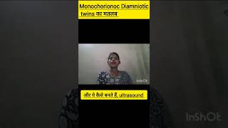 Monochorionoc Diamniotic twins pregnancy ka matalab monochorionoc Diamniotic twins kaise bnte hai [upl. by Adnirb]