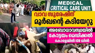 Snake Master Vava Suresh in Critical Condition Bitten by a Capturted Cobra at Kottayam [upl. by Antoinette158]