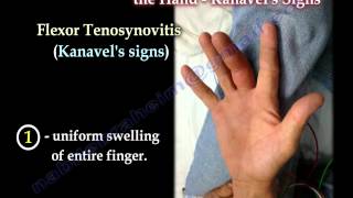 Flexor Tenosynovitis Of The Hand Kanavels Signs  Everything You Need To Know  Dr Nabil Ebraheim [upl. by Nuhs]