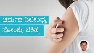 Fungal SkinInfections – Causes Symptoms And Treatment  Kannada [upl. by Aromas399]