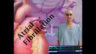 ATRIAL FIBRILLATION Diagnosis and Treatment [upl. by Attenaz]