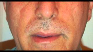 Time Lapse Moustache Growth [upl. by Kelsey]