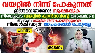 വയറ്റിൽ നിന്ന് പോകുന്നത് ഇങ്ങനെയാണോ വയറ്റിലെ ക്യാൻസറിന്റെ തുടക്കമാണ്  malathil blood malayalam [upl. by Blakeley438]