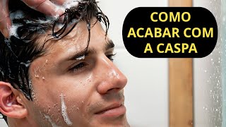 COMO ACABAR COM A CASPA [upl. by Horsey4]