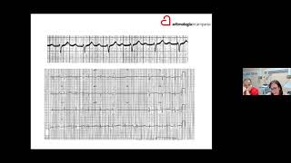 I corso  ECG nel paziente portatore di devices  8 luglio 2020  Webinar Modulo I [upl. by Casi]