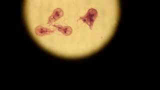 Giardia lamblia Trophozoite [upl. by Cheung19]