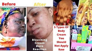 5 Types Of Body Cream You Should Not Apply Raw [upl. by Benton23]