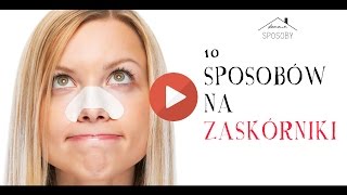 10 domowych sposobów na zaskórniki  Naturalne metody na wągry  cz1 [upl. by Dasteel]