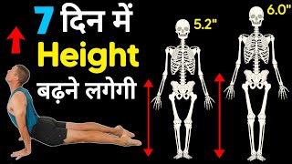 Height kaise badhaye  Height badhane ki dava  लंबाई कैसे बढ़ाएं Exercise [upl. by Hcra]