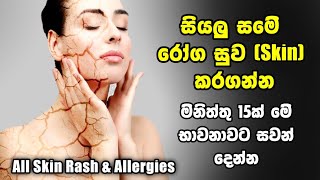 කොච්චර බෙහෙත් කලත් හොද වෙන්නැති ඕනම සමේ රෝගයක් මිතිත්තු 15න් සුව කරන බයිනුරල් භාවනාව [upl. by Lleuqar]