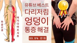 엉덩이통증 다리저림 허리통증 한번에 해결하는 운동 방법  이상근증후군 자가진단법과 안보면 후회하는 통증완화 스트레칭  PIRIFORMIS SYNDROME [upl. by Silver]