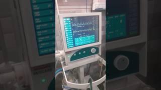 nicu baby  ventilator patient  beautiful baby  bollywood love music [upl. by Susejedairam]