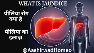 Jaundice  Hemolytic jaundice  Piliya ke lakshan  Why jaundice occurs [upl. by Ahsyla]