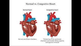 CHF vs Respiratory Failure Crucial Differences [upl. by Aniuqal]