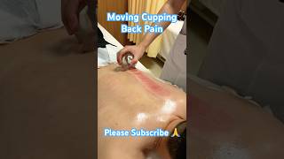 Moving Cupping🔥 Back Pain tcm viral cupping shorts youtubeshorts shortsfeed [upl. by Picker]