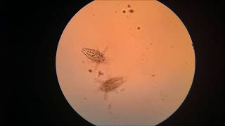 Zooplankton in the Microscope [upl. by Karame]