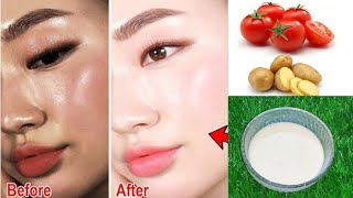 potato facial at home  potato facial at home step by step potato face pack for skin whitening [upl. by Haiacim]