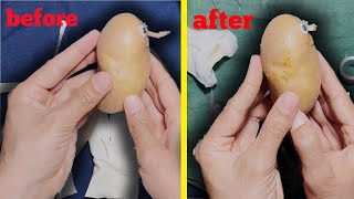 ASMR fruit surgery  How is rhinoplasty performed  nose plastic surgery [upl. by Brentt]