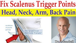 Fix Scalenus Trigger Points Quick Relief to Head Neck Arm Upper Back Pain  Dr Alan Mandell DC [upl. by Lapo84]