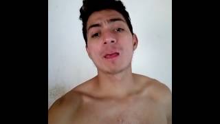 Gabriel segundo tratamento com Roacutan acne grau 4 e 5 [upl. by Yesrod]